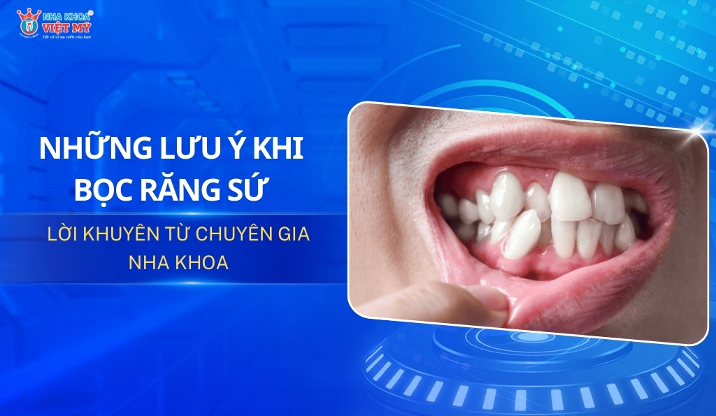 thumbnail những lưu ý khi bọc răng sứ