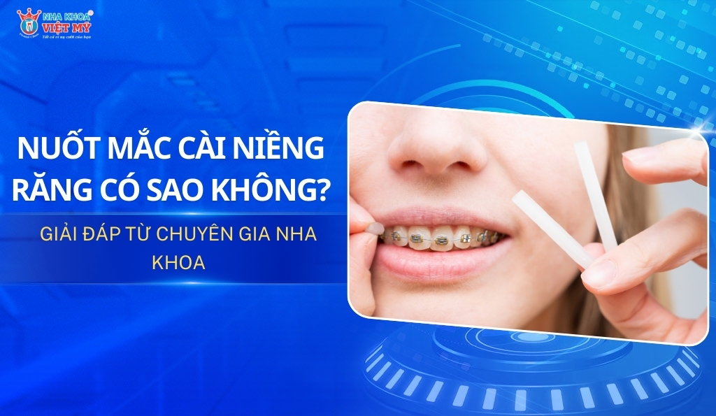 thumbnail nuốt mắc cài niềng răng có sao không