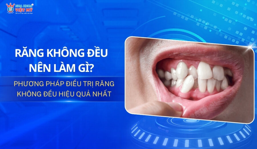 thumbnail răng mọc không đều nên làm gì