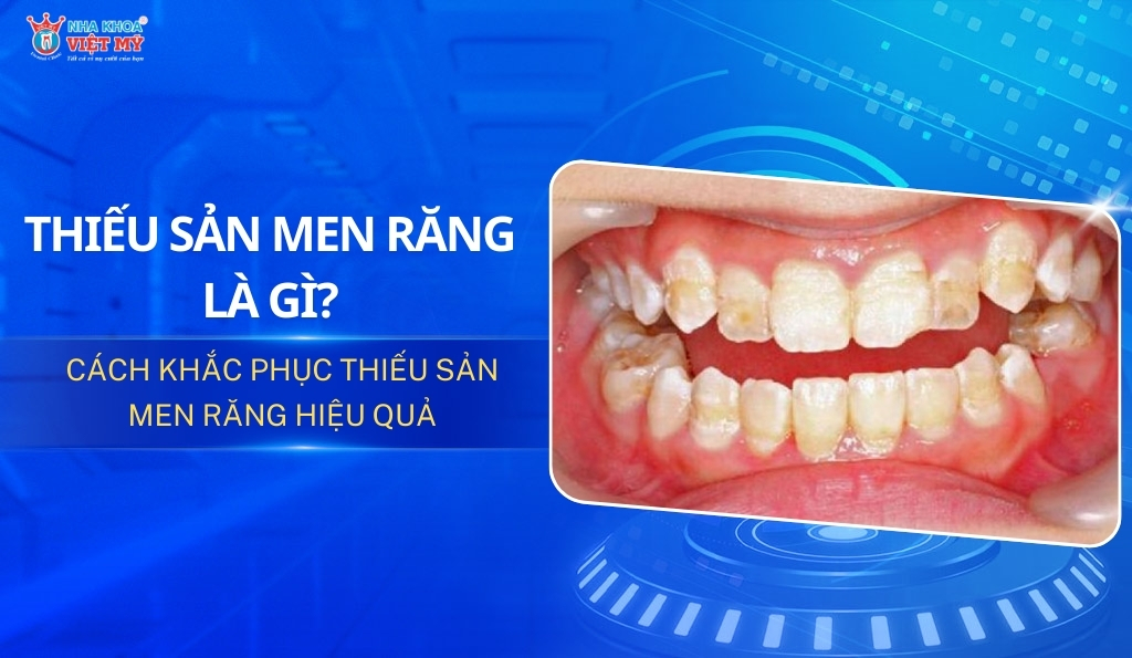 thumbnail thiểu sản men răng