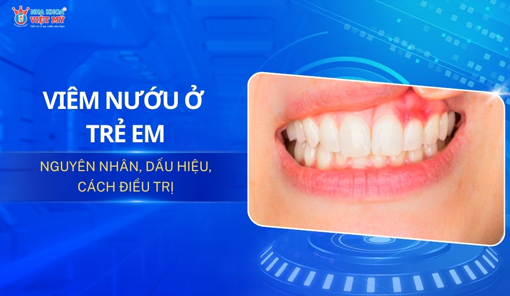 thumbnail viêm nướu răng ở trẻ em