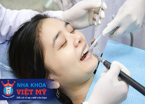 phòng khám nha khoa nhổ răng uy tín nhất tại Trà Vinh