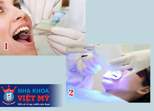 phòng khám nha khoa tẩy trắng răng chất lượng tại Sa Huỳnh