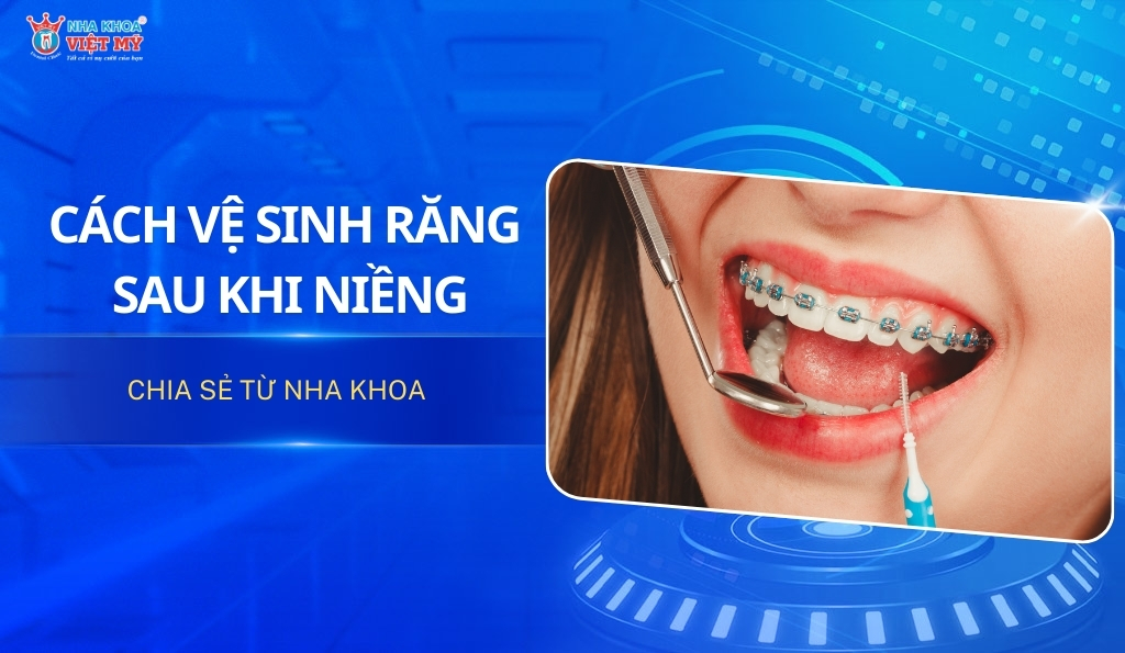 thumbnail cách vệ sinh răng miệng sau khi niềng