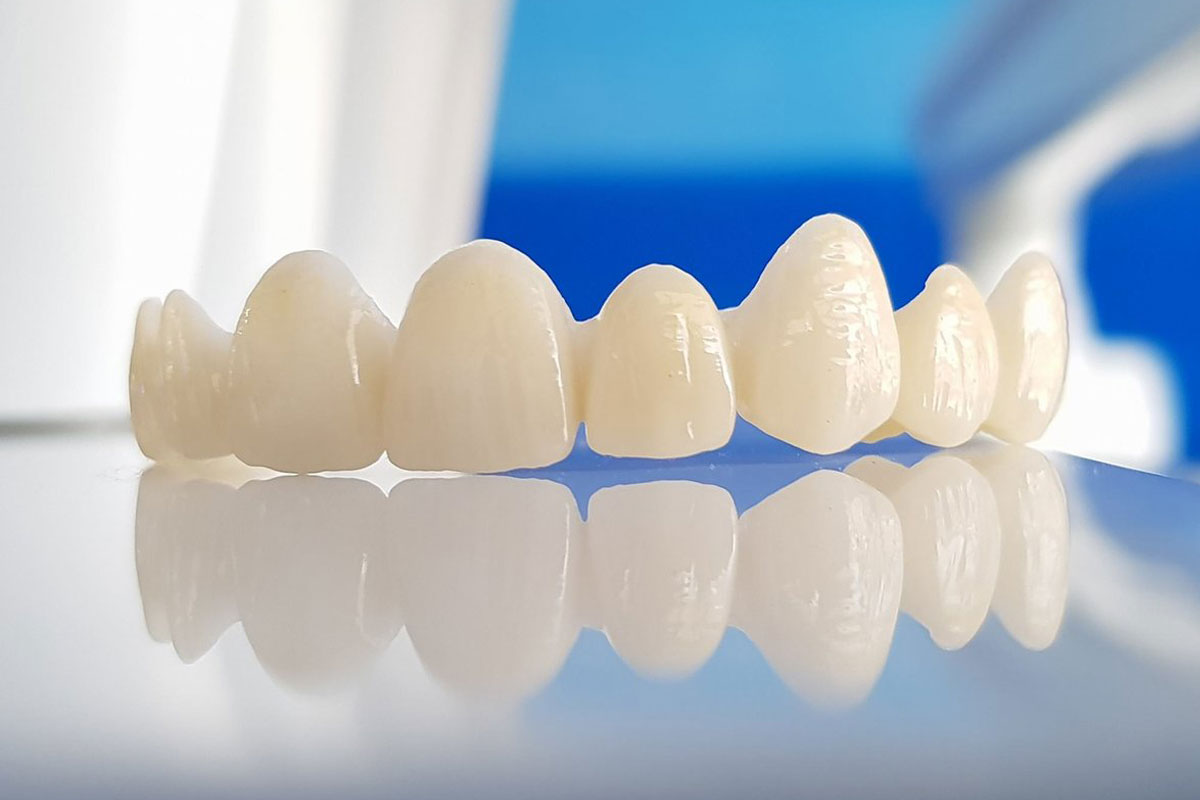  Răng sứ Zirconia là dòng răng toàn sứ có xuất xứ từ Đức 
