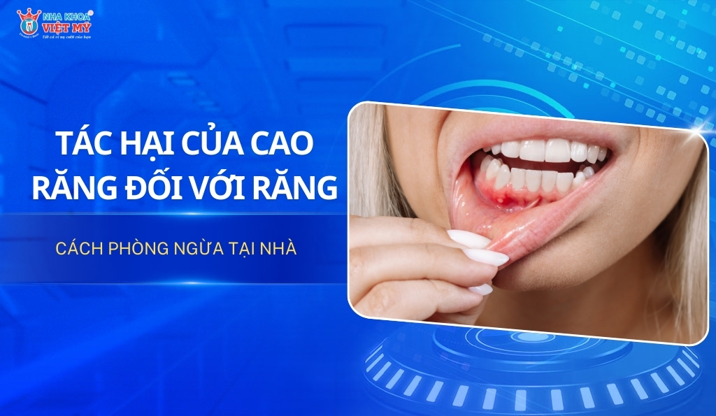 thumbnail tác hại của cao răng