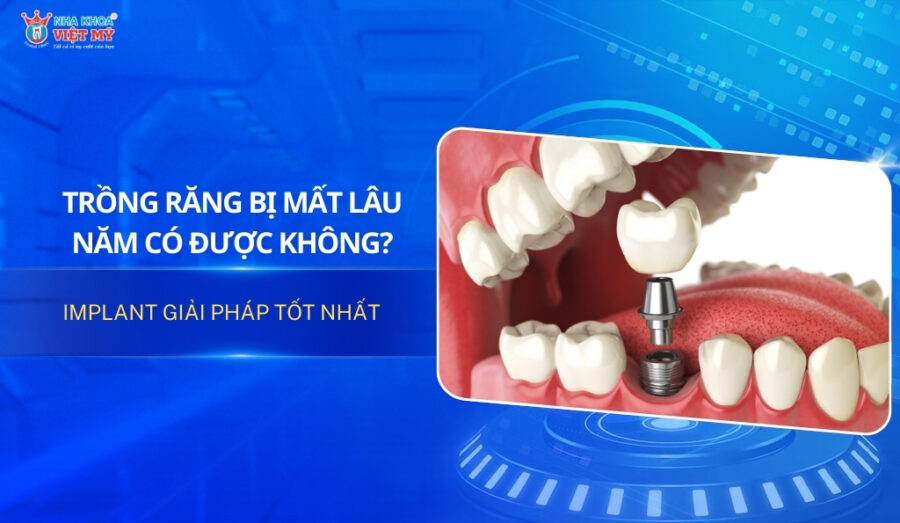 thumbnail trồng răng bị mất lâu năm bằng phương pháp implant