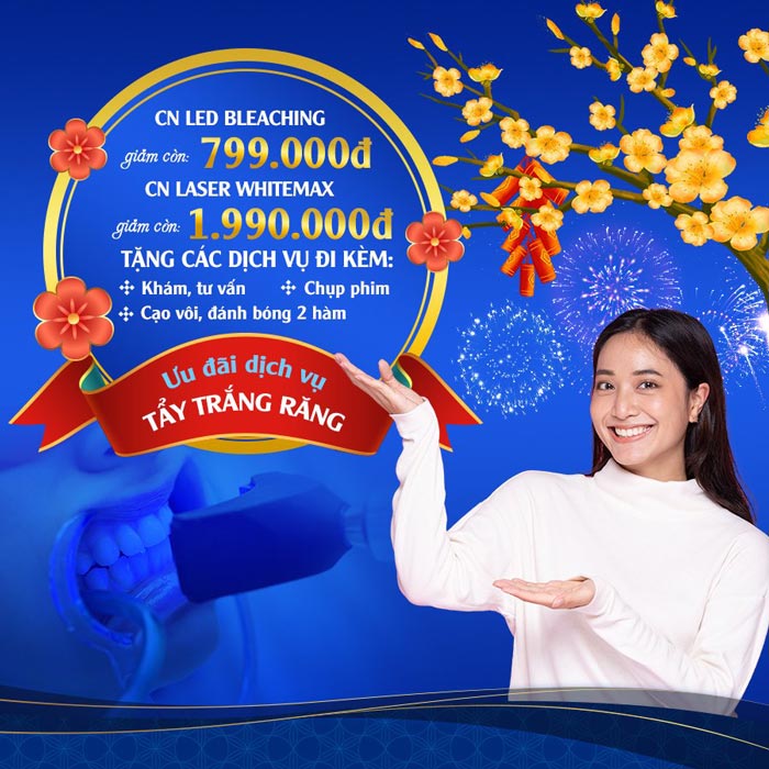 cong nghe tay trang rang tai Nha khoa Viet My