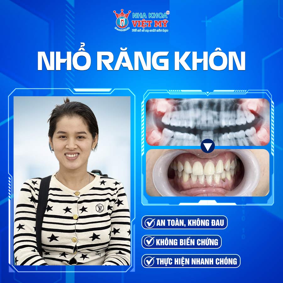 Ket-qua-Nho-rang-khon