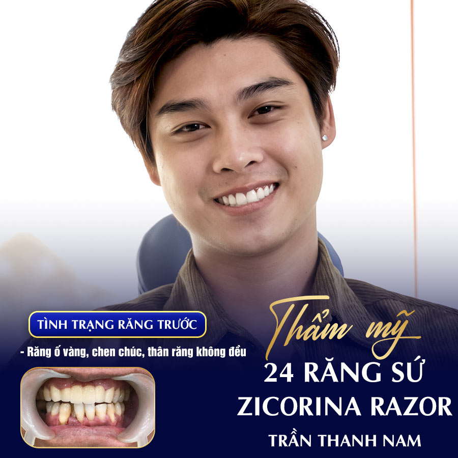 Răng sứ Ziconia Razor
