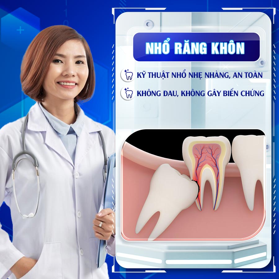 Dịch vụ nhổ răng khôn tại nha khoa Việt Mỹ