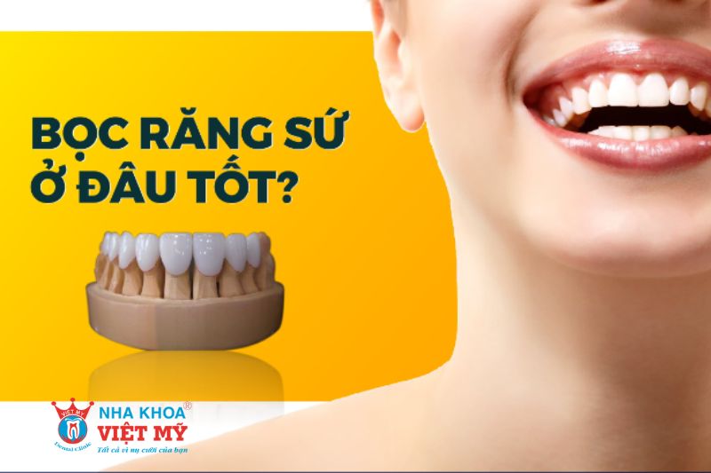 nên bọc răng sứ ở đâu để không bị đau và tốt nhất