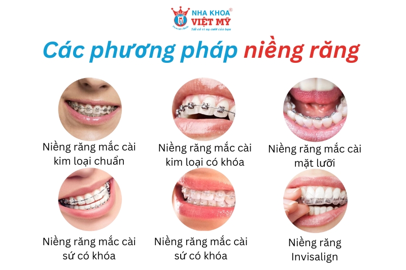 cac-phuong-phap-nieng-rang.jpg