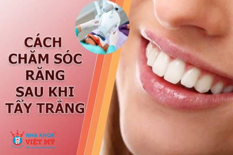 Hướng dẫn cách chăm sóc răng sau khi tẩy trắng răng