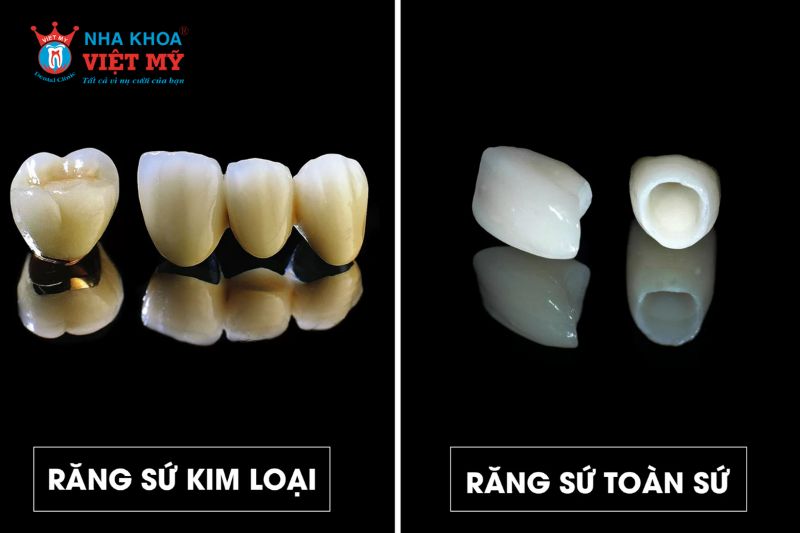 so sánh răng sứ kim loại và răng toàn sứ