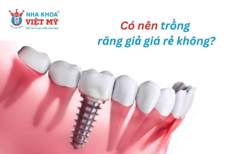 có nên trồng răng giả giá rẻ không