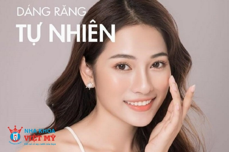 Dáng răng phong thủy tự nhiên