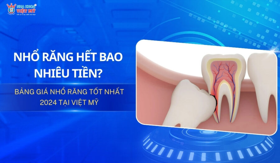 Thumbnail nhổ răng hết bao nhiêu tiền? Bảng giá nhổ răng tốt nhất 2024