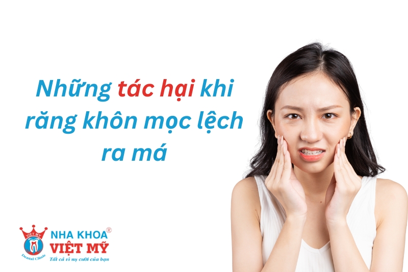 những tác hại khi răng khôn mọc lệch ra má