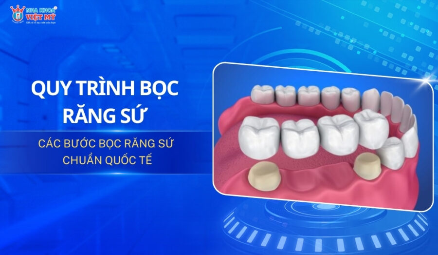 Thumbnail quy trình bọc răng sứ chuẩn quốc tế