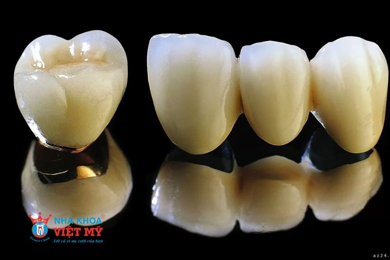 Tầm quan trọng của quy trình bọc răng sứ chuẩn quốc tế