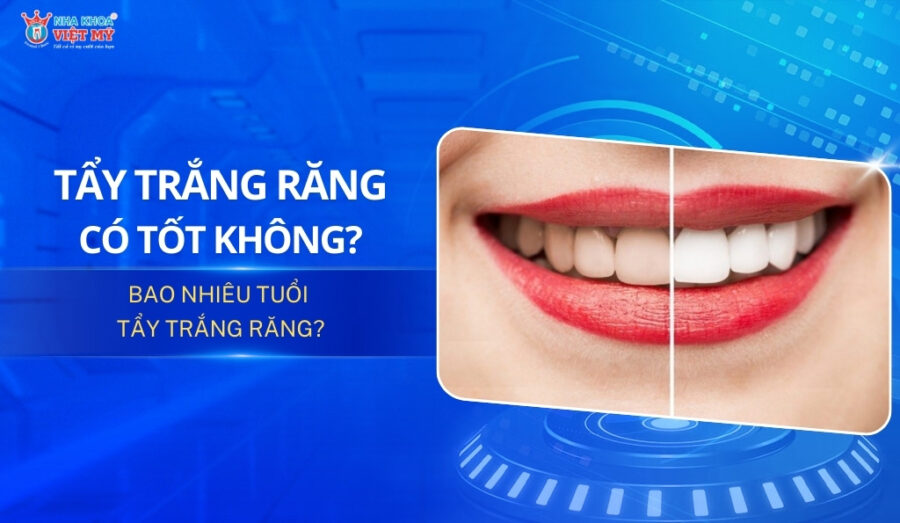 thumbnail tẩy trắng răng có tốt không, bao nhiêu tuổi nên tẩy trắng răng