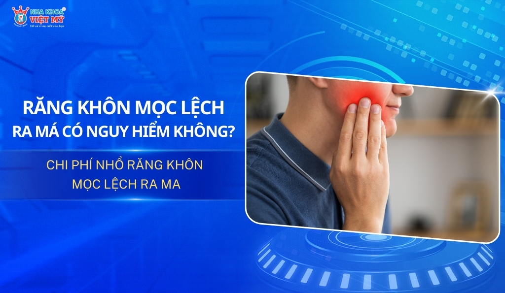 thumbnail răng không mọc lệch ra má có nguy hiểm không và chi phí bao nhiêu