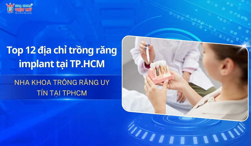 thumbnail top 12 nha khoa trồng răng uy tín