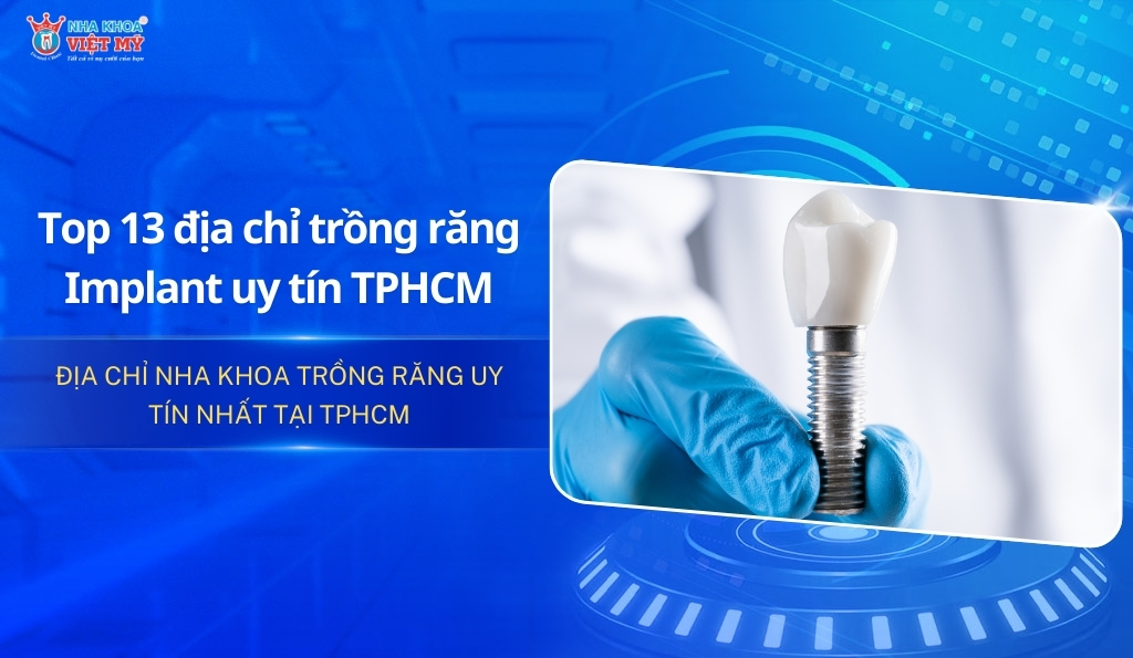 Top 13 Địa Chỉ Trồng Răng Implant Tại TPHCM Uy Tín [2025]