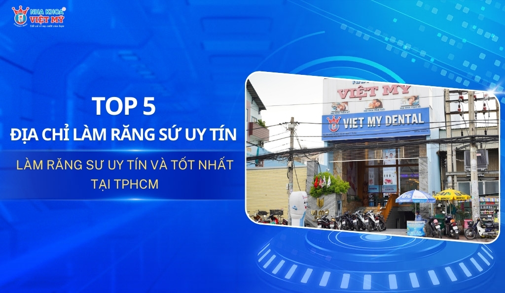 Thumbnail top 5 địa chỉ làm răng sứ uy tín và tốt nhất tại TPHCM