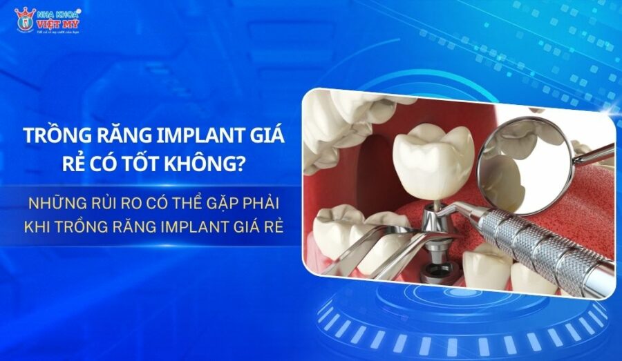 thumbnail trồng răng implant giá rẻ có tốt không
