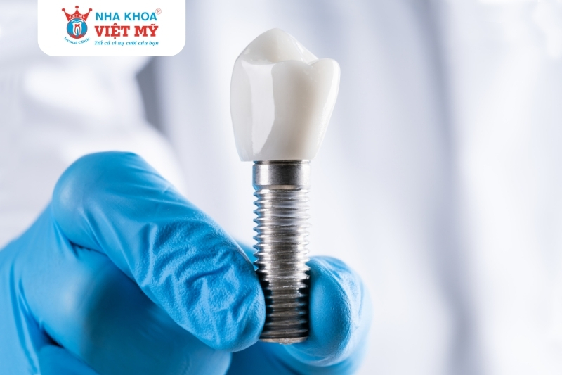 trụ răng implant tác động đến chi phí trồng răng implant