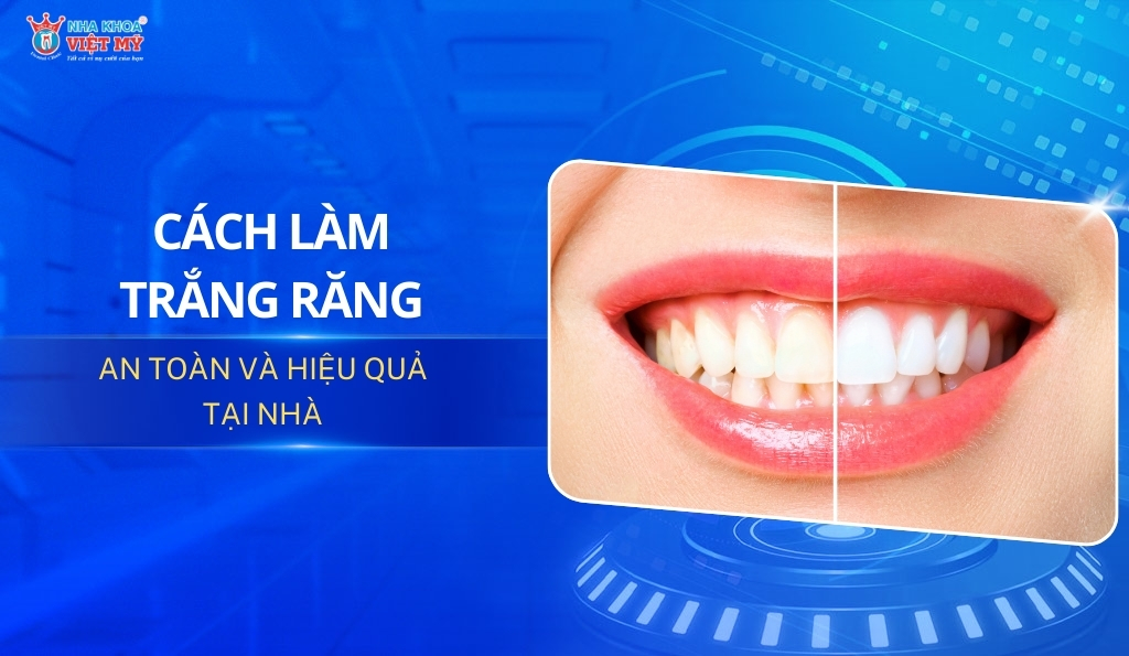 thumbnail cách làm trắng răng tại nhà an toàn và hiệu quả