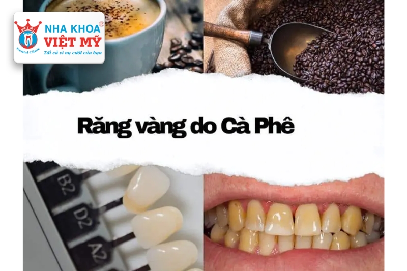 Cafe là một trong những nguyên nhân gây ố vàng răng