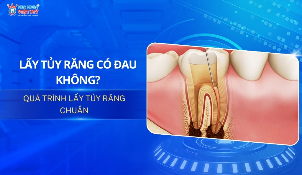 thumnail lấy tủy răng có đau không