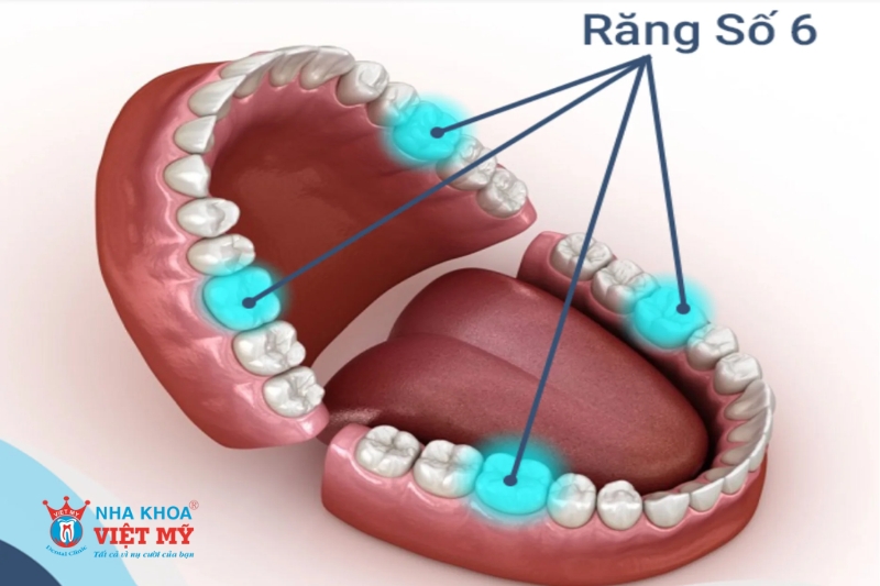 mất răng số 6 ảnh hưởng như thế nào