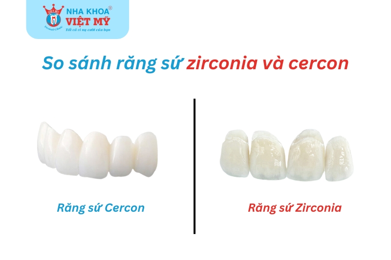 so sánh răng sứ zirconia và cercon