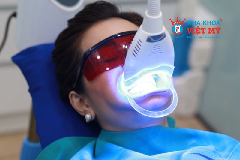 dịch vụ tẩy trắng răng bằng laser