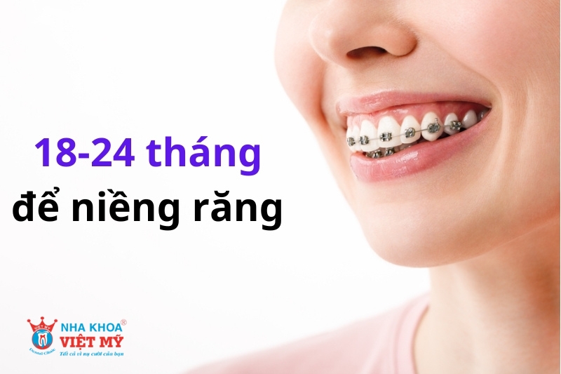 thời gian niềng răng chỉnh nha thông thường