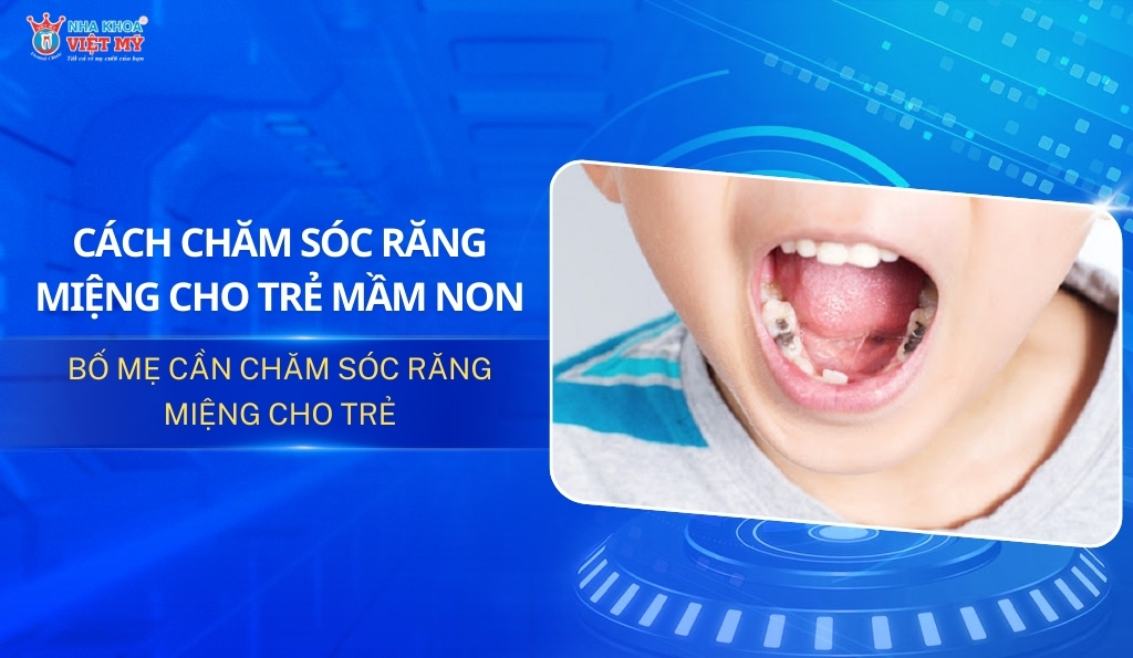 thumbnail cách chăm sóc răng miệng cho trẻ mầm non