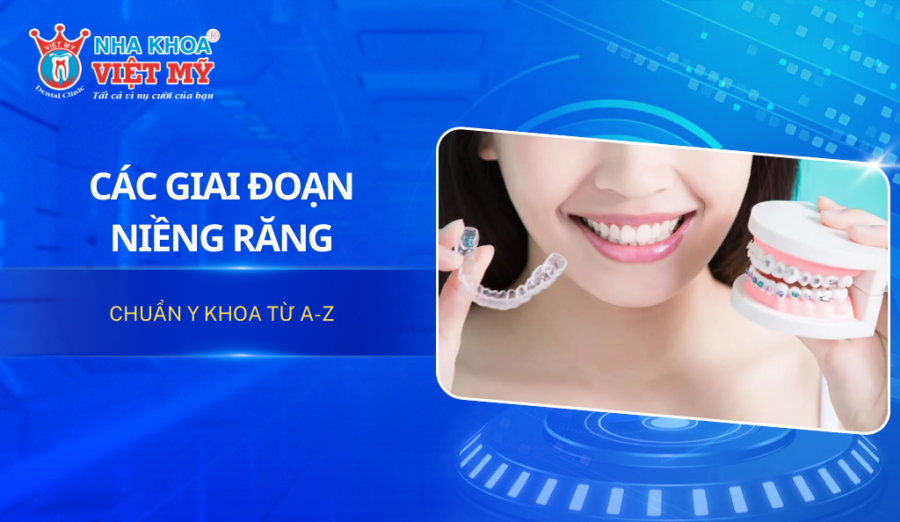 Các giai đoạn niềng răng chuẩn y khoa từ A-Z