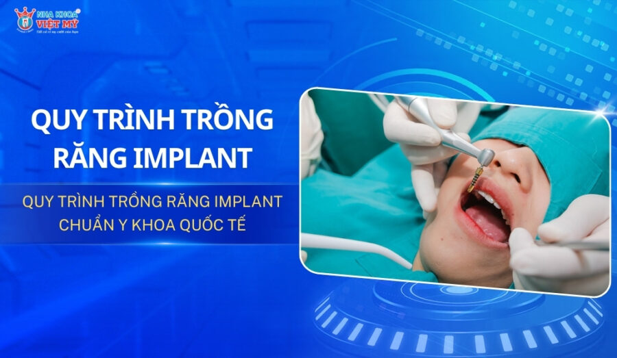 thumbnail quy trình trồng răng implant chuẩn y khoa quốc tế