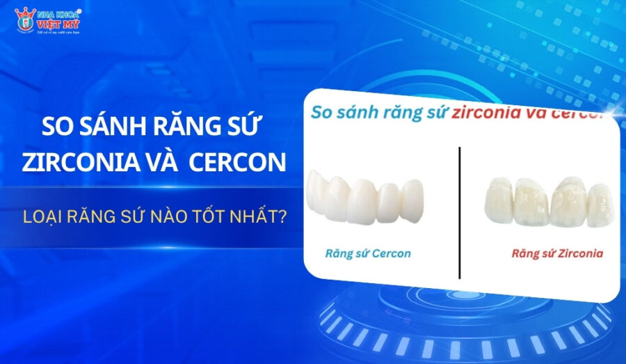 thumbnail so sánh răng sứ zirconia và cercon