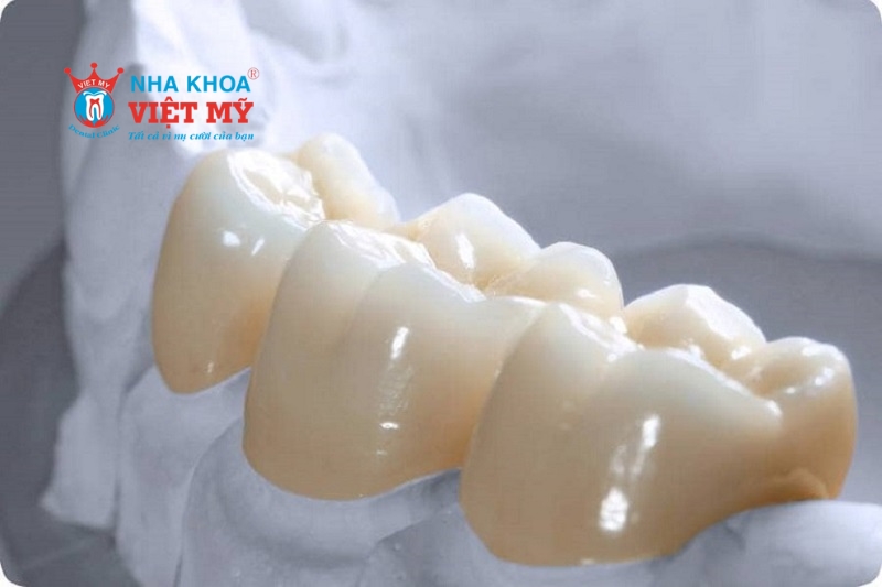 những loại răng sứ Zirconia hiện nay