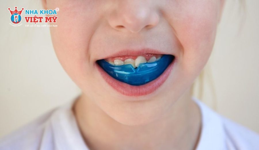 Từ 6-11 tuổi, trẻ thường được chỉ định đeo khí cụ trainer bằng cao su mềm vào ban đêm