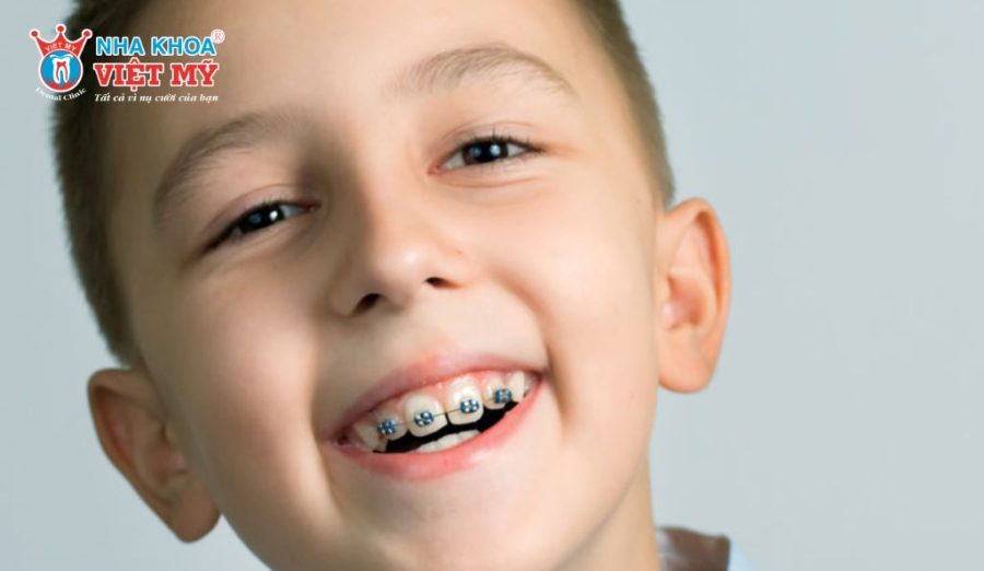 Độ tuổi niềng răng ảnh hưởng trực tiếp đến hiệu quả, thời gian và chi phí chỉnh nha