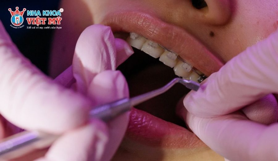 Mỗi phương pháp chỉnh nha được lựa chọn dựa trên độ tuổi và tình trạng răng miệng