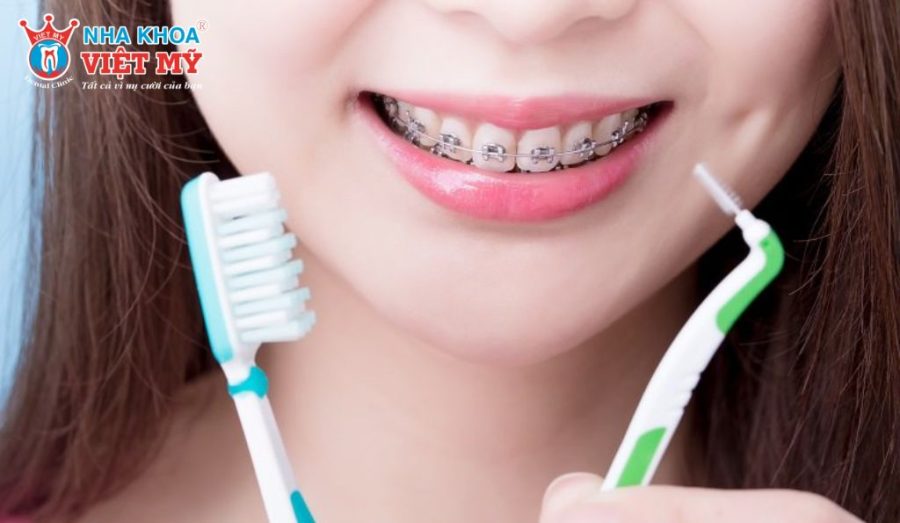 Vệ sinh răng miệng đúng cách giúp hạn chế viêm nướu và sâu răng trong quá trình niềng răng 1 hàm.