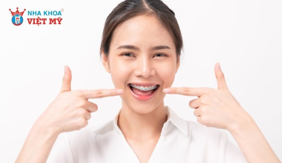 Niềng răng giúp khuôn mặt cân đối hơn, mức độ thay đổi tùy tình trạng răng và khớp cắn ban đầu