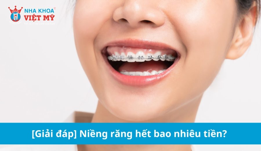 Giá niềng răng dao động từ 30.000.000 – 150.000.000 VNĐ trên thị trường